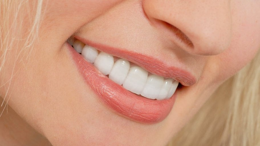 Why you should consider getting Hollywood smile treatment